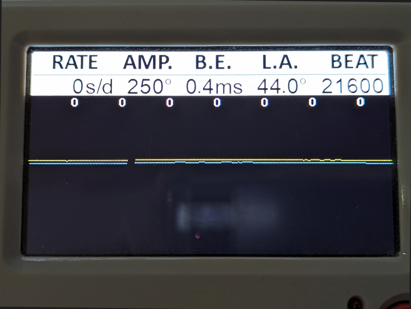 perfect performance on the timegrapher Sea-Gull ST3600: perfect performance on the timegrapher